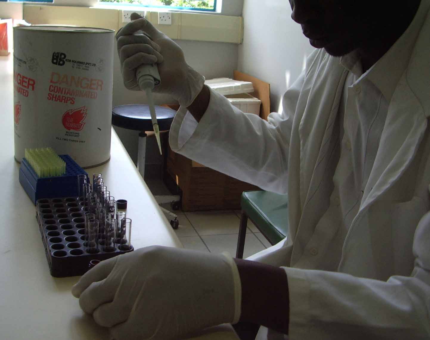 Processing CD4 counts in Ugandan lab. (Photo courtesy of irinnews.org)