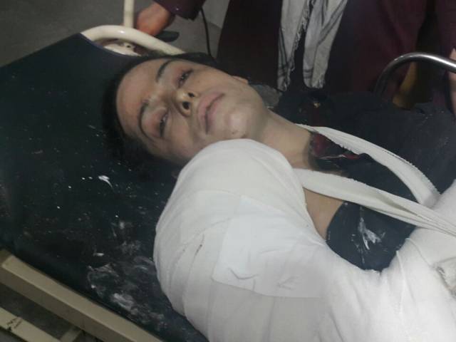 Alesha in the hospital. (Photo courtesy of Facebook)